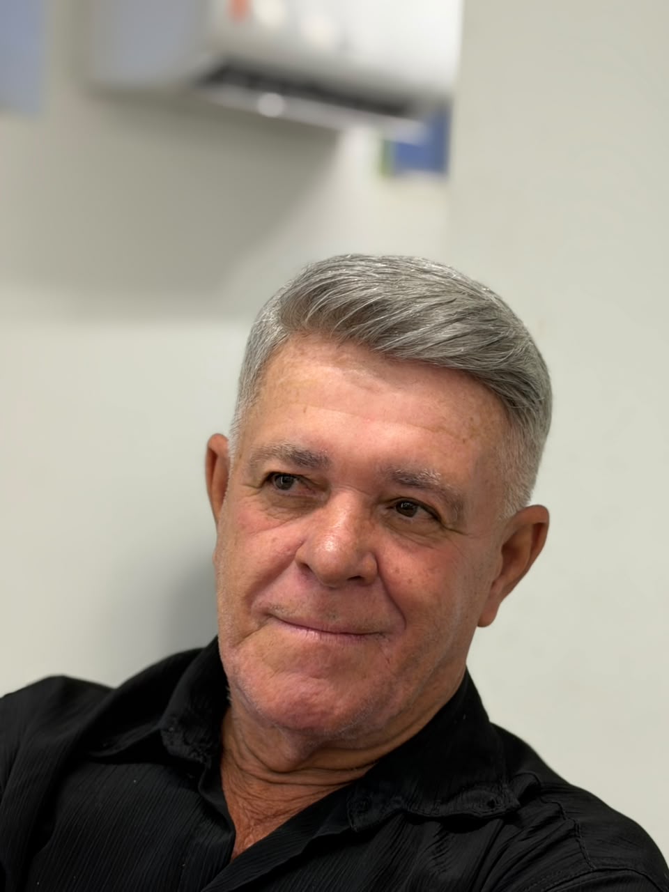 Depois — resultado de prótese capilar